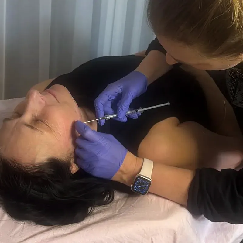 Ärztliche Behandlung mit feiner Kanüle im Wangenbereich